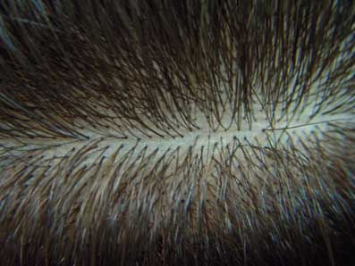 特殊医療用ウィッグ　人毛１００％　リアルな分け目で通気性もあります。